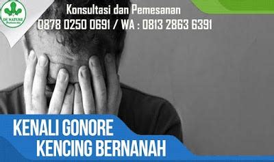 Langkah 4: Mengatur Pengaturan Grup untuk Mencegah Tindakan Serupa Muncul